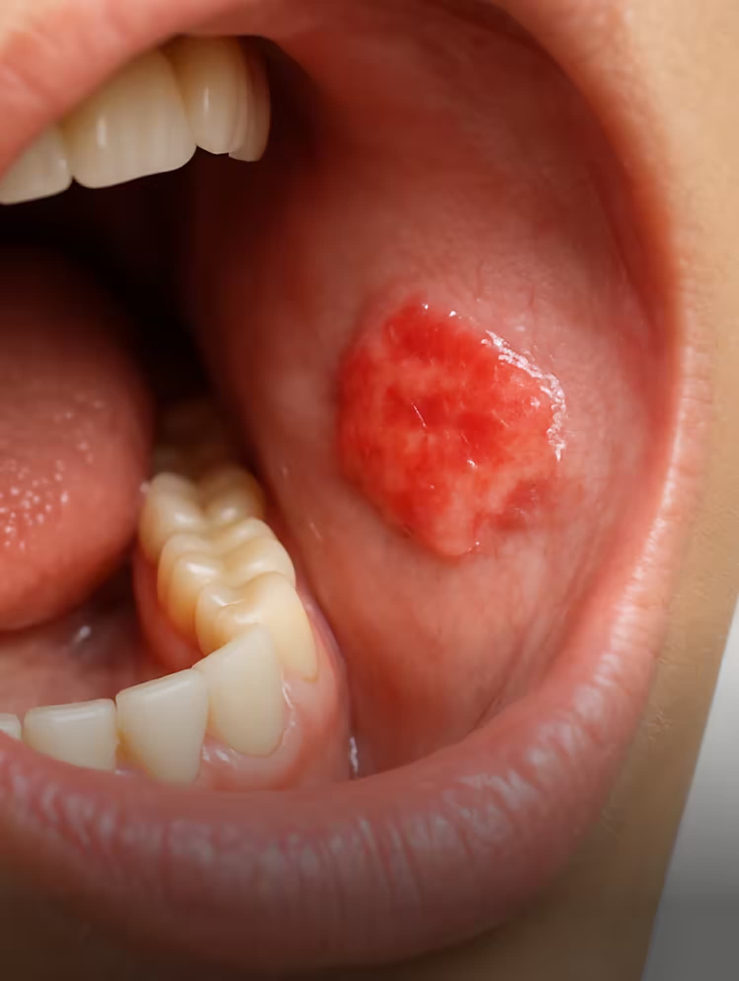 Soft Tissue Screening