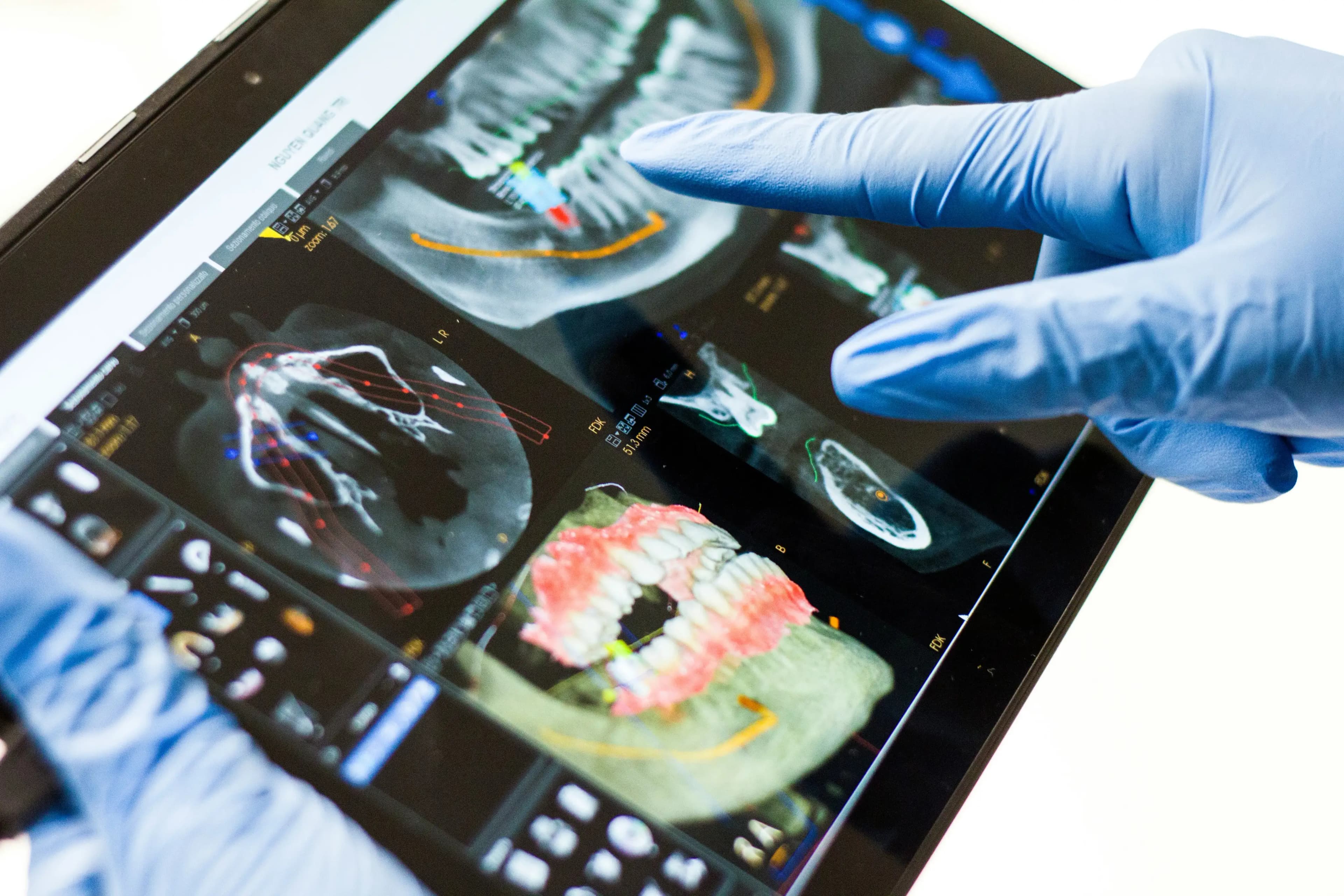 CBCT Hero Image